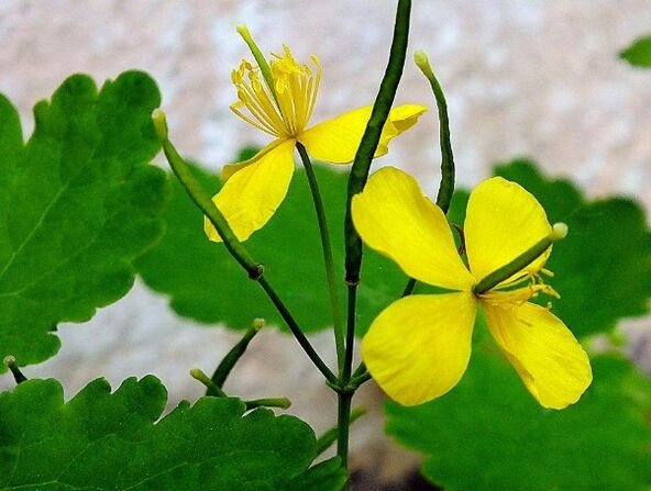 Celandine zur Behandlung von Psoriasis
